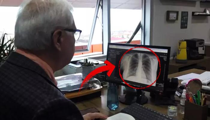 prof. Dr. Özlü uyardı: "Vakalar arttı"! İşte en belirgin semptom...