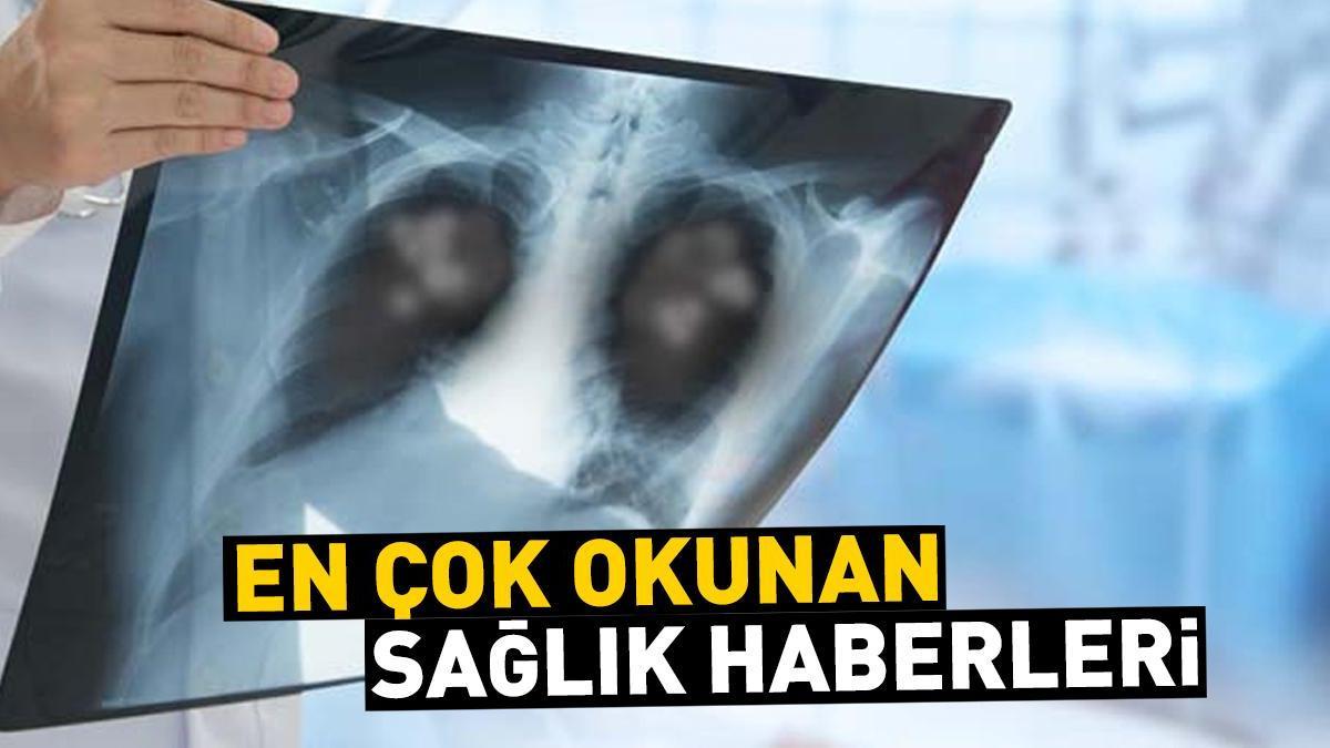 Günün en önemli sağlık haberleri, 6 Ağustos 2024...